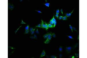 Immunofluorescence staining of HepG2 cells with ABIN7170953 at 1:166, counter-stained with DAPI. (SULT1A3 抗体  (AA 1-295))