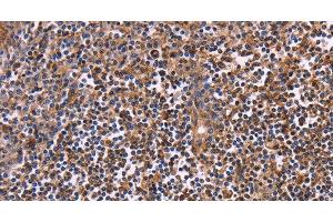 Immunohistochemistry of paraffin-embedded Human tonsil using CLUAP1 Polyclonal Antibody at dilution of 1:50 (CLUAP1 抗体)