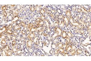 Immunohistochemistry (IHC) image for anti-Transthyretin (TTR) (AA 20-147) antibody (ABIN7429271)