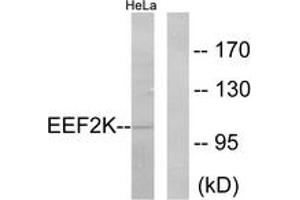 Western blot analysis of extracts from HeLa cells, treated with serum 10% 15', using eEF2K (Ab-366) Antibody.