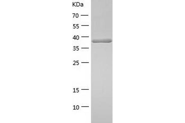 SQSTM1 Protein (AA 85-440) (His tag)