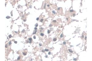 Immunohistochemistry (IHC) image for anti-Barrier To Autointegration Factor 1 (BANF1) (AA 2-89) antibody (ABIN7444295)