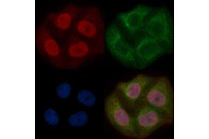 WDR70 Mouse Monoclonal Antibody staining Hela cells by IF/ICC. (WDR70 抗体)