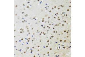 Immunohistochemistry of paraffin-embedded mouse brain using BTK antibody (ABIN5970757) at dilution of 1/100 (40x lens). (BTK 抗体)