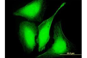 Immunofluorescence of purified MaxPab antibody to GAS2L3 on HeLa cell. (GAS2L3 抗体  (AA 1-694))