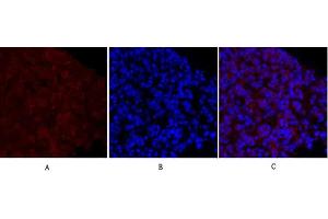 Immunofluorescence analysis of mouse lung tissue. (MEK1/2 抗体)