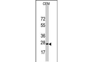 Western blot analysis of BARX1 polyclonal antibody  in CEM cell line lysates (35 ug/lane). (BARX1 抗体  (C-Term))