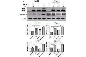 Western Blotting (WB) image for anti-Sequestosome 1 (SQSTM1) (AA 51-150) antibody (ABIN682153)