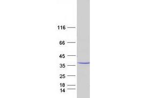Western Blotting (WB) image for Myelin Protein Zero-Like 1 (MPZL1) (Transcript Variant 1) protein (Myc-DYKDDDDK Tag) (ABIN2726307)