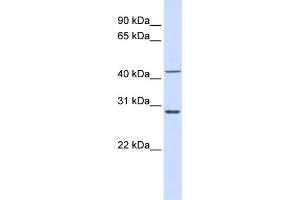 WB Suggested Anti-RPL3 Antibody Titration:  0. (RPL3 抗体  (N-Term))