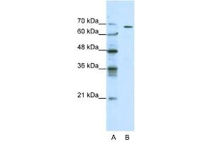 GABRQ antibody used at 0. (GABRQ 抗体)