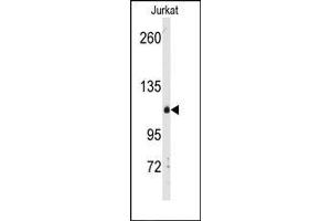 Image no. 1 for anti-Diacylglycerol Kinase, delta 130kDa (DGKD) (C-Term) antibody (ABIN360608) (DGKD 抗体  (C-Term))