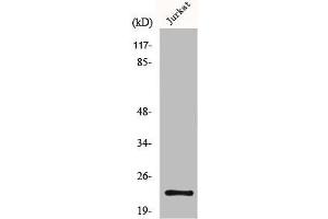 Western Blot analysis of Jurkat cells using MGMT Polyclonal Antibody (MGMT 抗体  (N-Term))