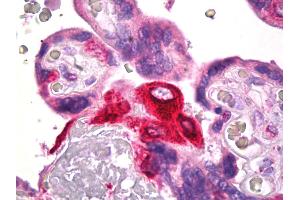 Anti-PTGES antibody IHC of human placenta. (Prostaglandin E Synthase 抗体)