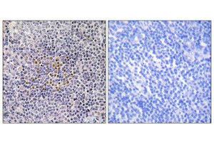 Immunohistochemistry (IHC) image for anti-X-Ray Repair Complementing Defective Repair in Chinese Hamster Cells 3 (XRCC3) (Internal Region) antibody (ABIN1850510) (XRCC3 抗体  (Internal Region))