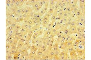 Immunohistochemistry of paraffin-embedded human liver tissue using ABIN7148440 at dilution of 1:100 (CRX 抗体  (AA 120-285))
