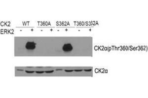 Western blot of CK2α(Phospho- Thr360/Ser362) antibody and CK2α antibody in vitro kinase assay. (CSNK2A1/CK II alpha 抗体  (pSer362, pThr360))