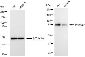 Western blotting analysis using PRKCSH antibody (ABIN7799984). (Recombinant PRKCSH 抗体)