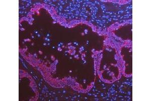 anti-Keratin 8 (KRT8) (AA 107-325) antibody