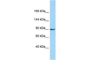 Host: Rabbit Target Name: CRNKL1 Sample Type: Jurkat Whole Cell lysates Antibody Dilution: 1. (CRNKL1 抗体  (C-Term))