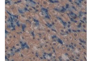 Immunohistochemistry (IHC) image for anti-ATP-Binding Cassette, Sub-Family C (CFTR/MRP), Member 1 (ABCC1) (AA 1219-1469) antibody (ABIN7440026)