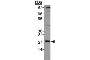 Western blot analysis of PSMD10 in HeLa lysate using with PSMD10 polyclonal antibody . (PSMD10 抗体  (AA 100-200))