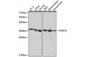 Western blot analysis of extracts of various cell lines using MNAT1 Polyclonal Antibody at dilution of 1:1000. (MNAT1 抗体)