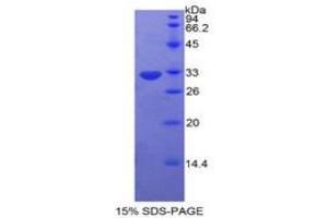 SDS-PAGE analysis of Human Protein Kinase C Eta Protein. (PKC eta 蛋白)