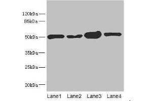 Western blot All lanes: CHN1 antibody at 6. (CHN1 抗体  (AA 1-200))