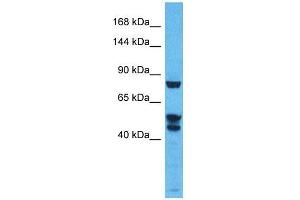 Host:  Rabbit  Target Name:  KDM3B  Sample Type:  Thymus Tumor lysates  Antibody Dilution:  1. (KDM3B 抗体  (N-Term))