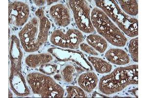 Image no. 3 for anti-Melan A (MLANA) antibody (ABIN1499425) (MLANA 抗体)