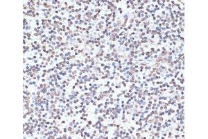 Immunohistochemistry (Paraffin-embedded Sections) (IHC (p)) image for anti-Protein Kinase, AMP-Activated, alpha 1 Catalytic Subunit (PRKAA1) (pThr172), (pThr183) antibody (ABIN7265094)