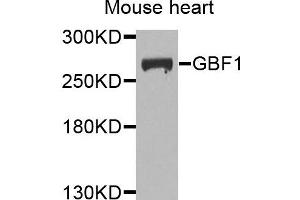 Western blot analysis of extracts of mouse heart cells, using GBF1 antibody. (GBF1 抗体)