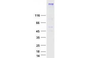 Validation with Western Blot