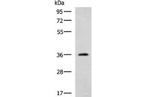 Western Blotting (WB) image for anti-ATPase, Na+/K+ Transporting, beta 2 Polypeptide (ATP1B2) antibody (ABIN7248239)