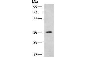 Western blot analysis of Human cerebella tissue lysate using ATP1B2 Polyclonal Antibody at dilution of 1:650 (ATP1B2 抗体)