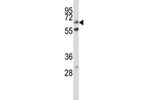 ALP antibody western blot analysis in HeLa lysate (Alkaline Phosphatase 抗体  (AA 282-309))