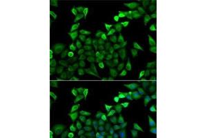 Immunofluorescence analysis of A-549 cells using TPSAB1 Polyclonal Antibody (TPSAB1 抗体)