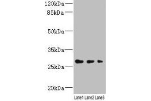 Western blot All lanes: LRRC57 antibody at 4 μg/mL Lane 1: Mouse liver tissue Lane 2: Mouse kidney tissue Lane 3: Mouse lung tissue Secondary Goat polyclonal to rabbit IgG at 1/10000 dilution Predicted band size: 27 kDa Observed band size: 27 kDa (LRRC57 抗体  (AA 1-239))