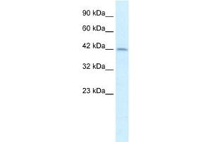 WB Suggested Anti-PAX3 Antibody Titration:  2. (Paired Box 3 抗体  (Middle Region))