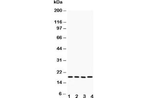 Western blot testing of Caveolin-2 antibody and Lane 1:  HeLa (Caveolin 2 抗体  (AA 1-162))