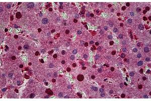 Human Liver: Formalin-Fixed, Paraffin-Embedded (FFPE) (FZR1 抗体  (AA 1-494))