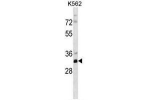 PRPS2 Antibody (Center) western blot analysis in K562 cell line lysates (35µg/lane). (PRPS2 抗体  (Middle Region))