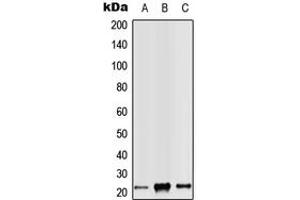 Western blot analysis of RAB14 expression in Jurkat (A), Raw264. (RAB14 抗体  (C-Term))