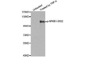 Western blot analysis of extracts from 293 cells untreated or treated with TNF-a using Phospho-NFKB1-S932 antibody (ABIN2988211). (NFKB1 抗体  (pSer932))