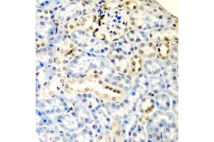 Immunohistochemistry of paraffin-embedded mouse kidney using DCTD antibody at dilution of 1:200 (40x lens). (DDX1 抗体)