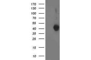 Western Blotting (WB) image for anti-Leucine Carboxyl Methyltransferase 1 (LCMT1) antibody (ABIN1499106) (LCMT1 抗体)