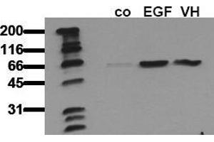 Western Blotting (WB) image for anti-V-Akt Murine Thymoma Viral Oncogene Homolog 1 (AKT1) (pSer473) antibody (ABIN126853) (AKT1 抗体  (pSer473))