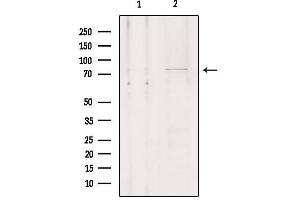 Western blot analysis of extracts from Hela, using SLCO1A2 Antibody. (SLCO1A2 抗体  (Internal Region))