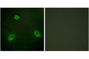 Immunofluorescence analysis of HepG2 cells, using TM16G Antibody. (Anoctamin 7 抗体  (AA 881-930))
